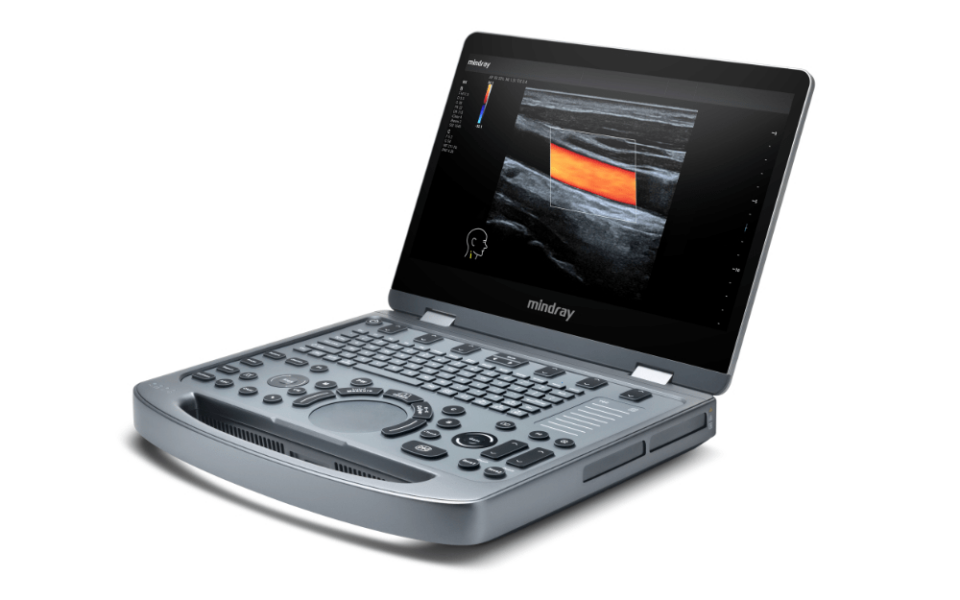Ecografo portatile Mindray MX3