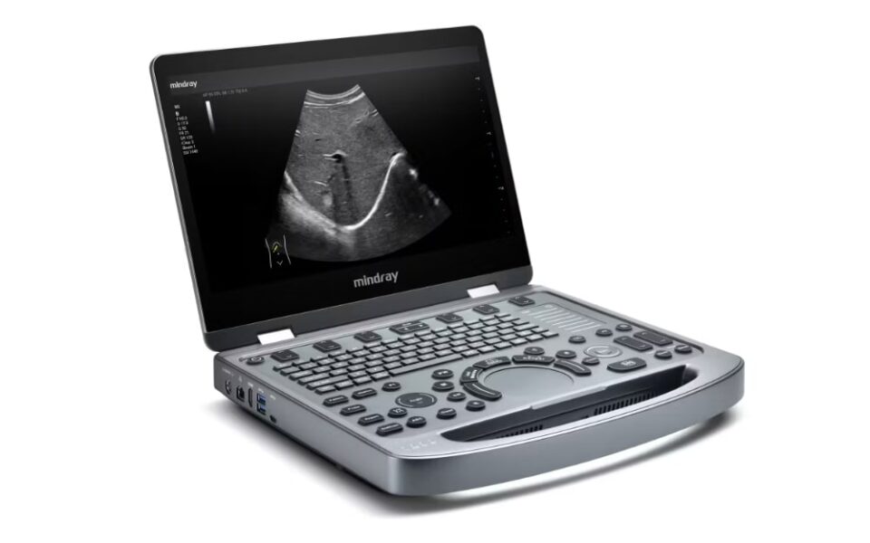 Ecografo portatile Mindray MX5